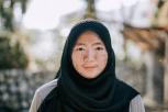 Mitos dan Fakta seputar Vitiligo Pemahaman yang Perlu Diketahui